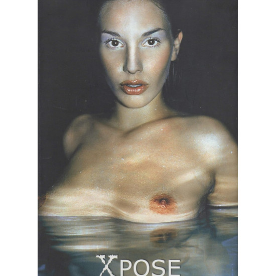 Xpose