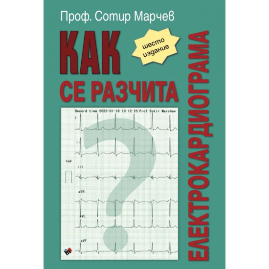 Как се разчита електрокардиограма Как се разчита електрокардиограма
