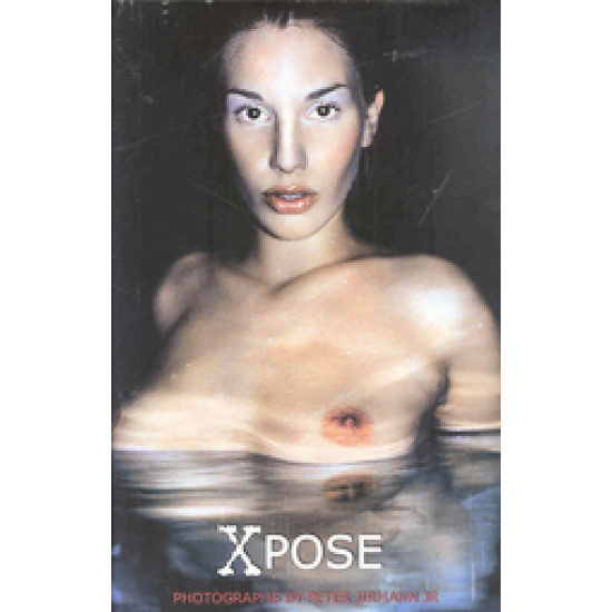 Xpose